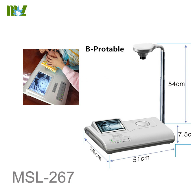 luz localizadora de venas MSL-267