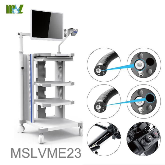 costo de endoscopia MSLVME23