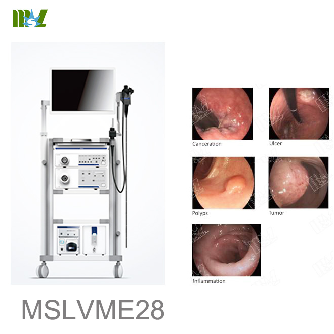 prueba de endoscopia MSLVME28