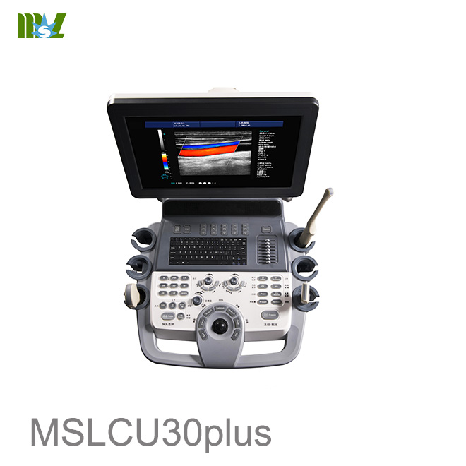 ultrasonido intrauterino