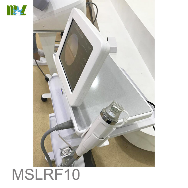 microagujado de radiofrecuencia