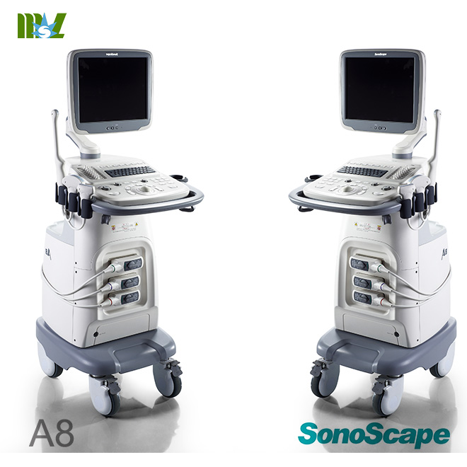 fetal doppler ultrasound
