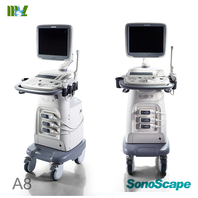 4 d ultrasound pics