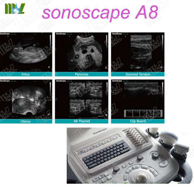 obstetric doppler