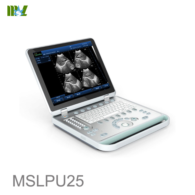 ultrasonido obstetrico