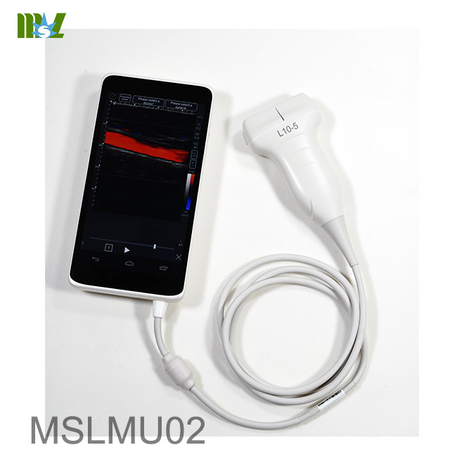 ultrasonido de smartphone