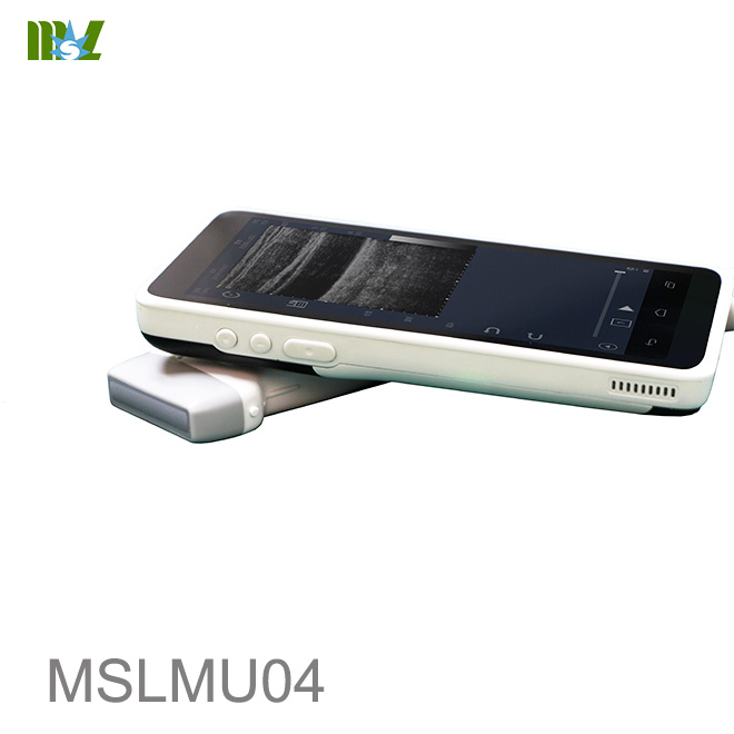ultrasonido inteligente