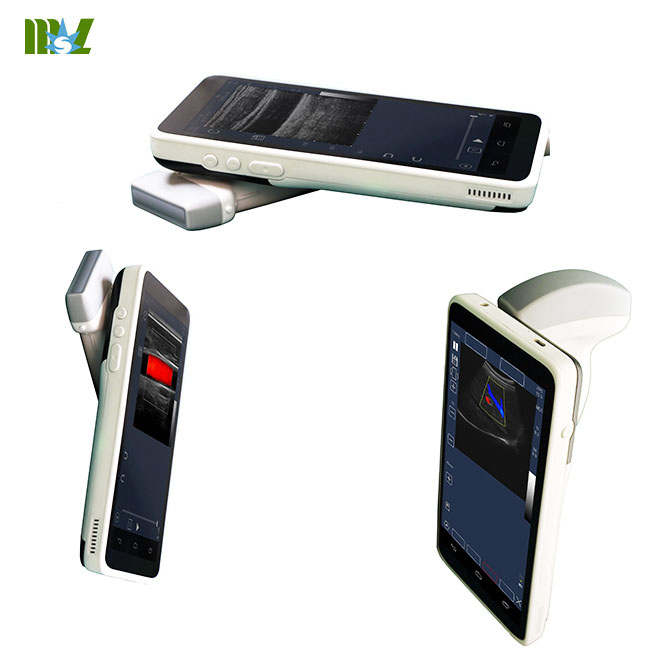 ultrasonido de bolsillo