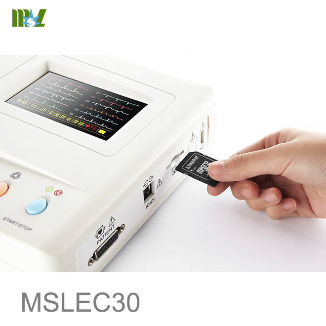 mediciones de electrocardiograma