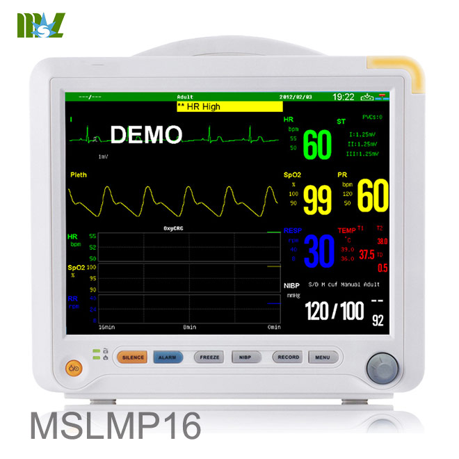 monitor de hospital