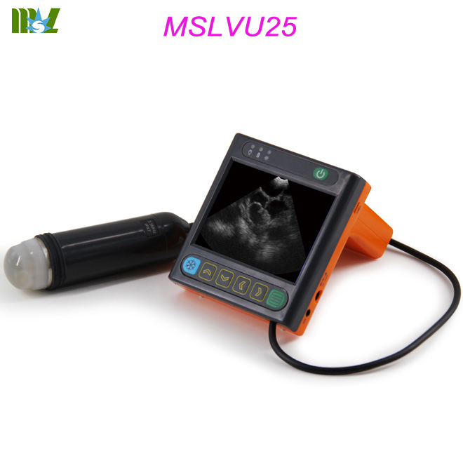 ultrasonido portátil