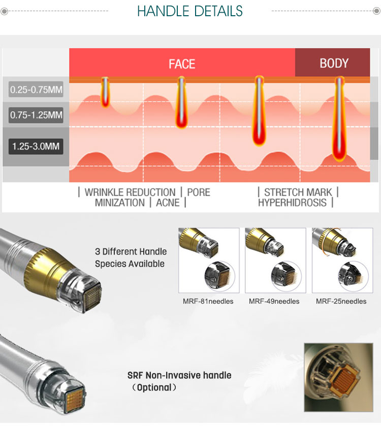 RF MICRONEEDLE