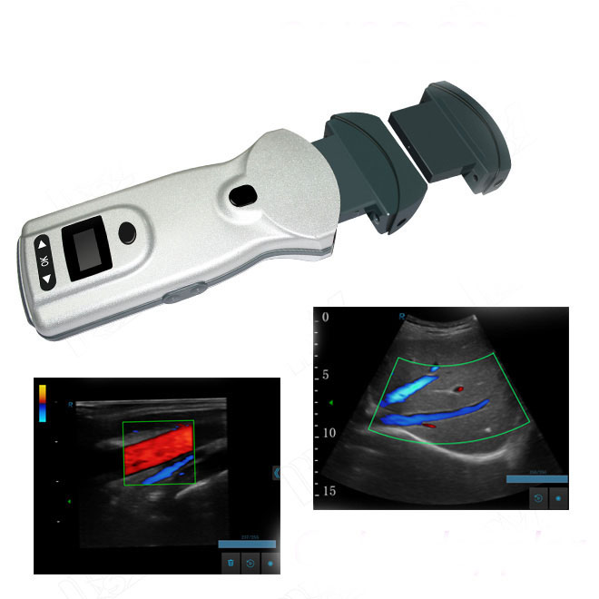 doppler en color MSLCU89