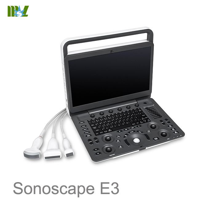 doppler ultrasound pregnancy