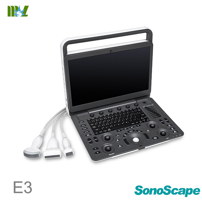 sonoscape E3 price list