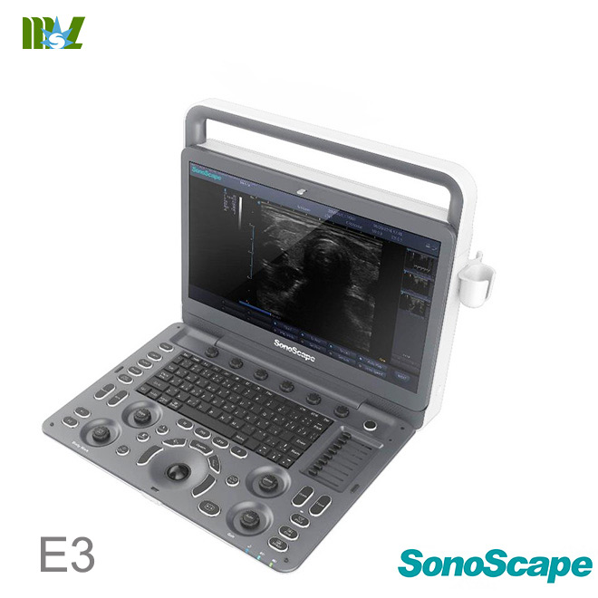 sonoscape E3
