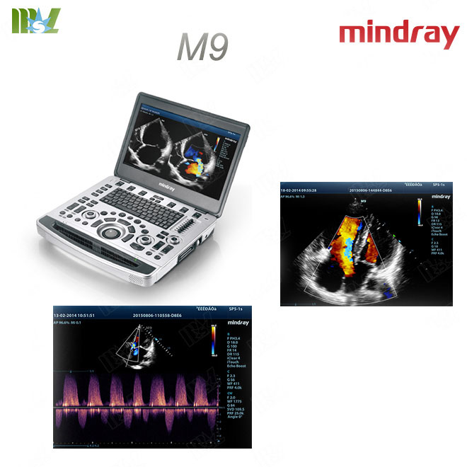 venous doppler mindray m9