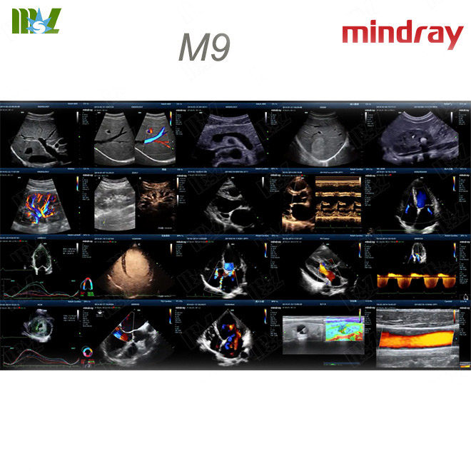 color doppler mindray m9