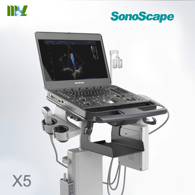sonoscape X5 baby images20 week ultrasound