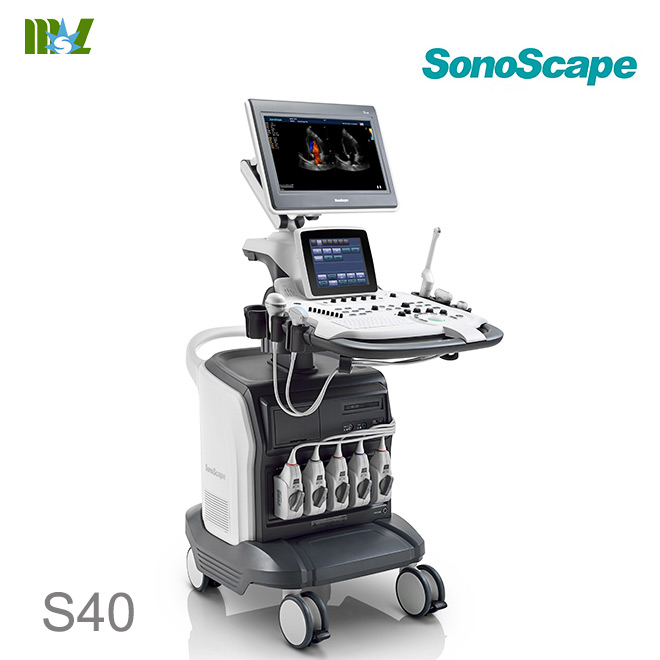 Sonoscape S40 3d scanner