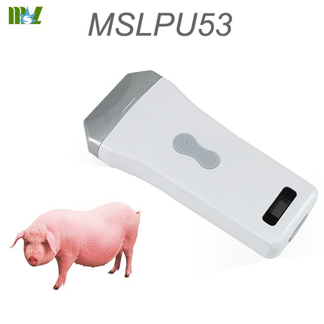 sonda de ultrasonido para iPhone