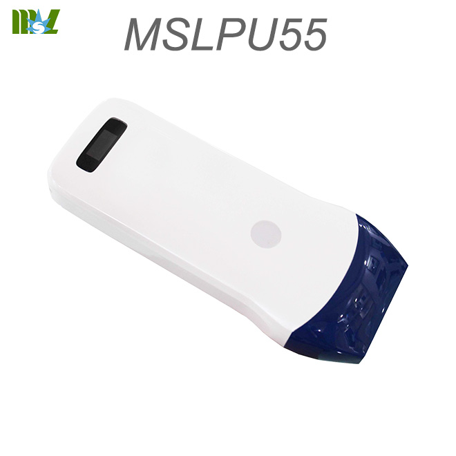 doppler scan MSLPU54