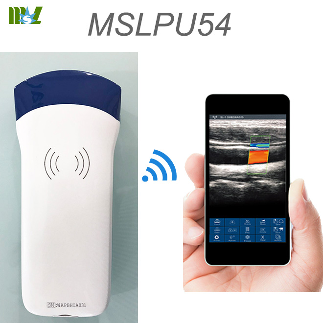 prueba de doppler MSLPU54