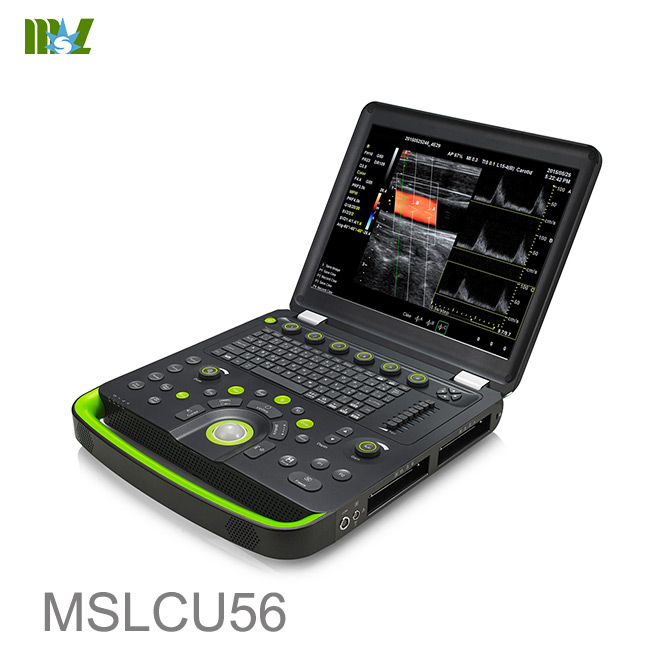 ultrasonido 3D