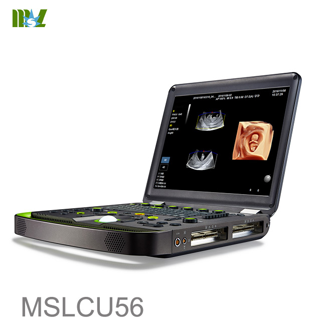 ultrasonido de diagnóstico