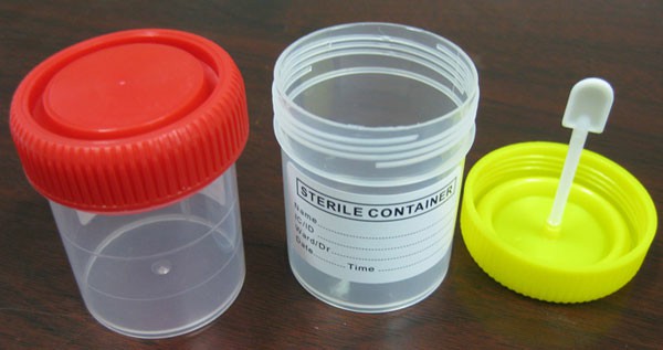 Contenedor de muestra de heces