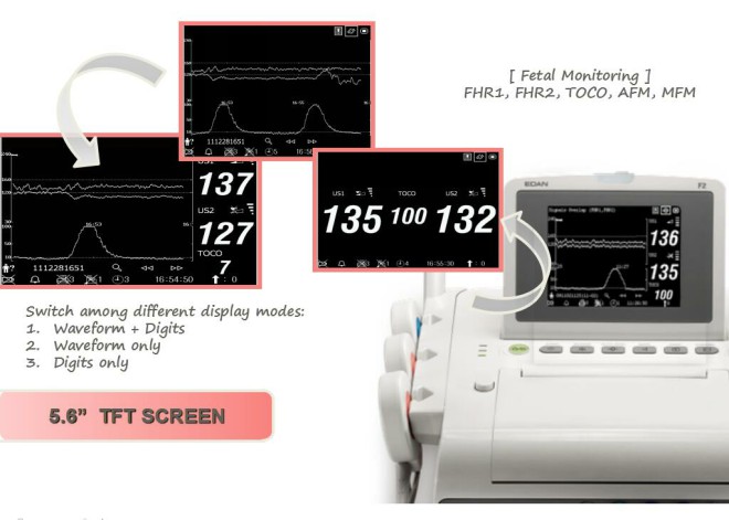 edan monitor