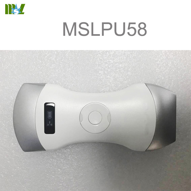 ultrasonido móvil