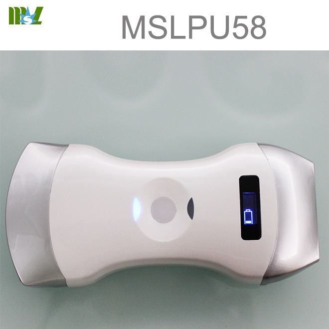 sonda de ultrasonido para iPhone