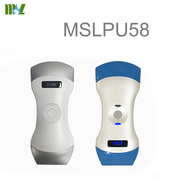 Máquina de ultrasonido portátil
