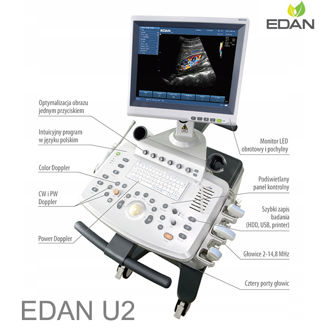 EDAN U2 color doppler ultrasound