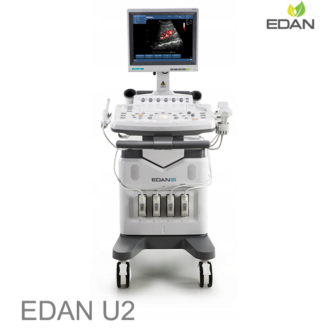 EDAN U2 doppler scan