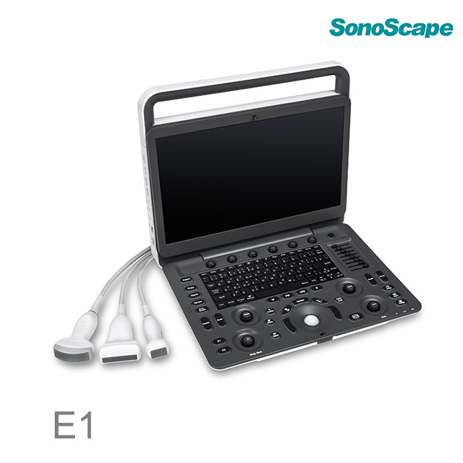 sonoscape e1