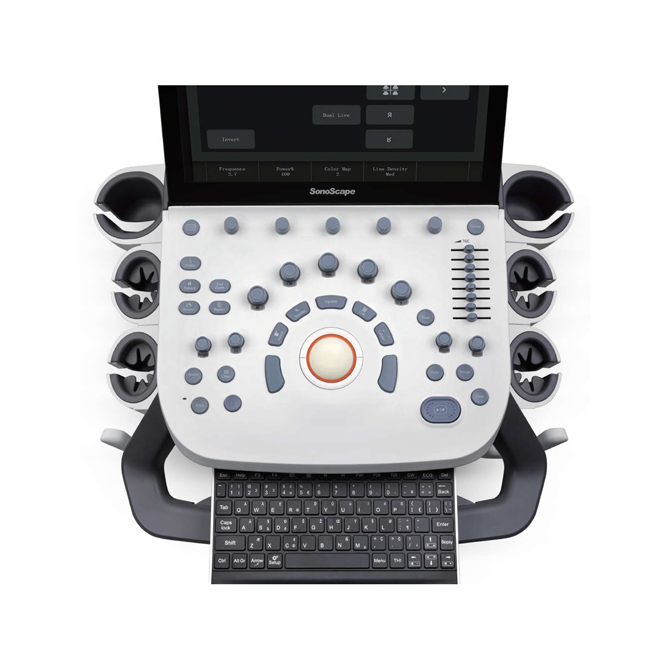Proveedor de dispositivo de ultrasonido Doppler Sonoscape P9