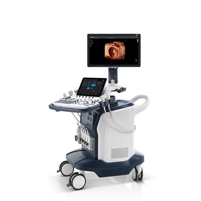 ultrasound sonoscape s60