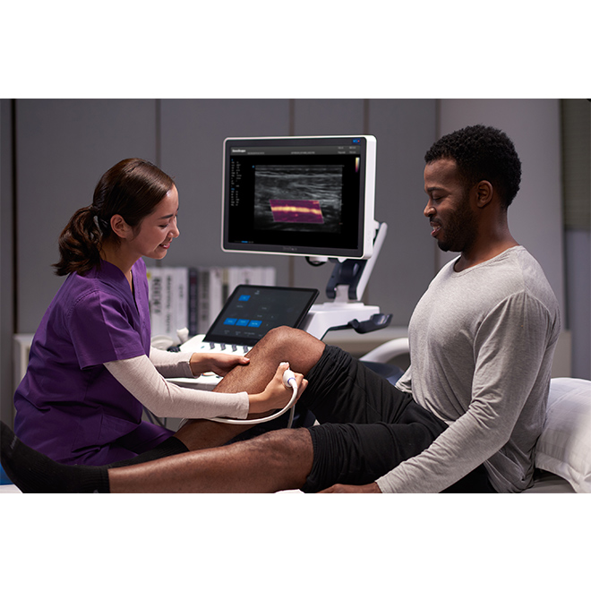 ultrasound sonoscape s60