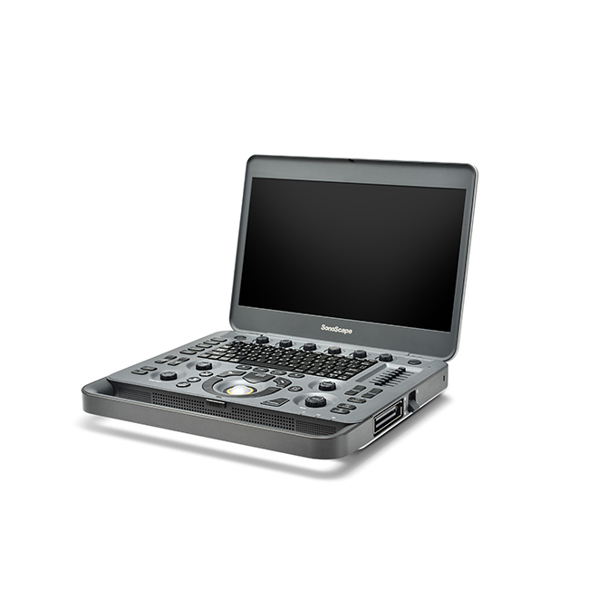 ultrasound sonoscape x3v