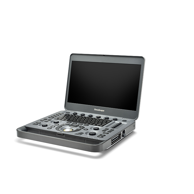 ultrasound sonoscape x5v