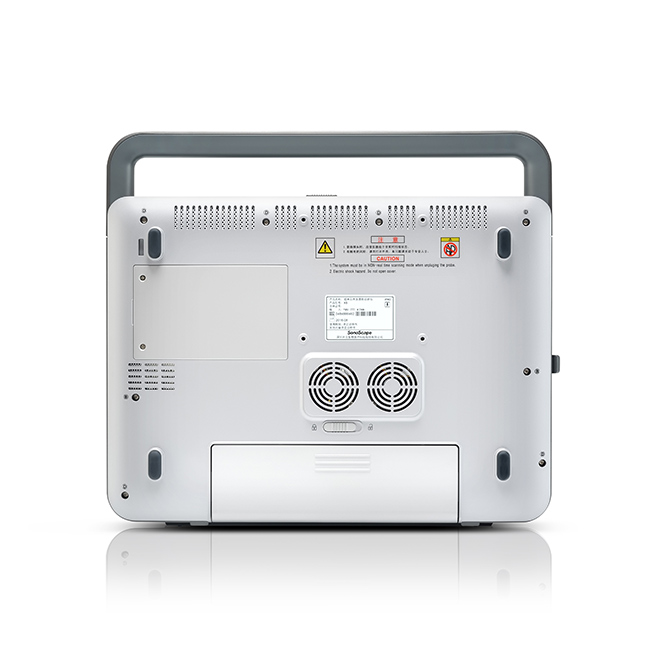 ultrasound sonoscape x5v