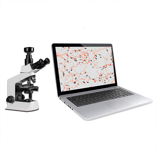 Analizador de Calidad de Espermatozoides MSL3705